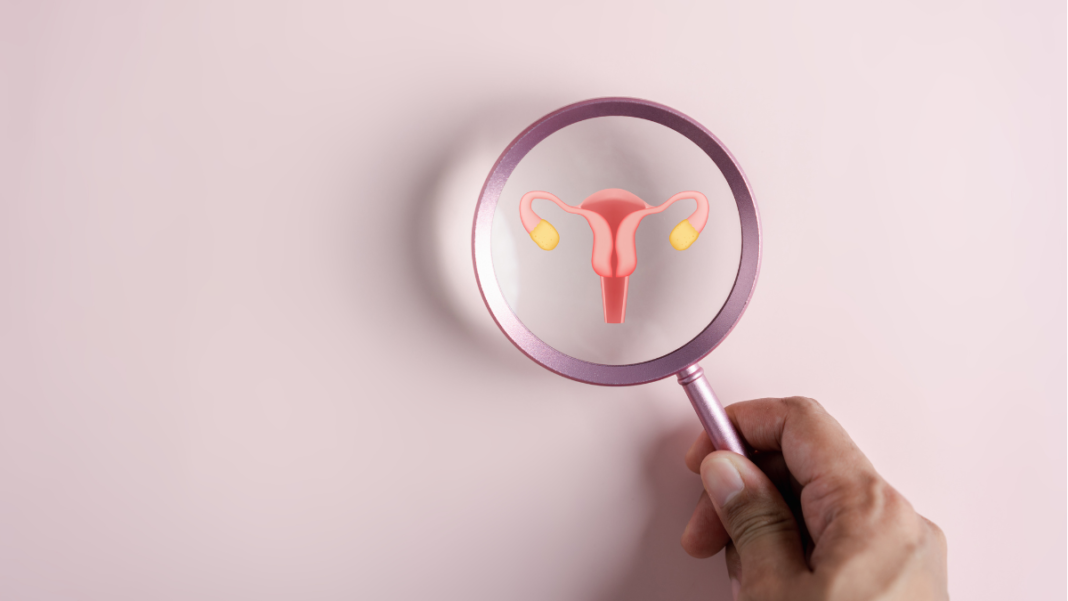 A doctor holds a magnifying glass over the female reproductive system, highlighting the uterus and ovaries.
